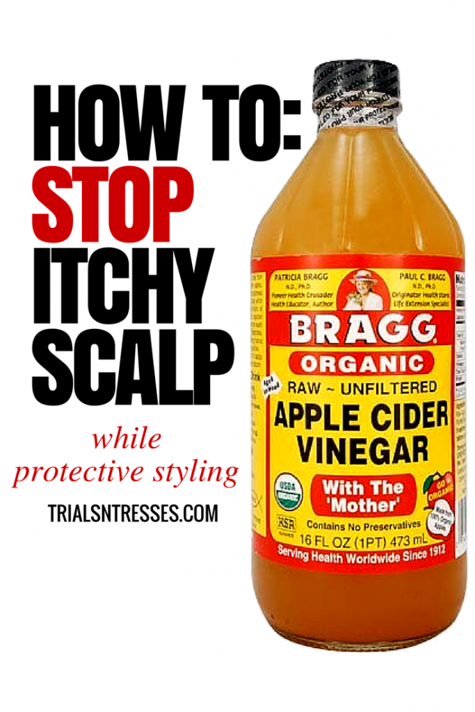 stop itchy scalp